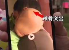 北青报：“大头娃娃”再敲儿童食品安全警钟